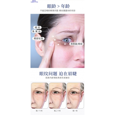 婕尔_美容院玻尿酸微针眼贴